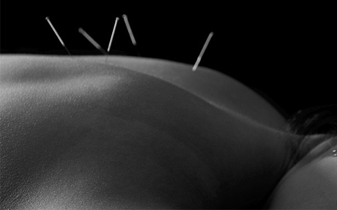 Acupuncture and the Ancient Art of Improving Fertility